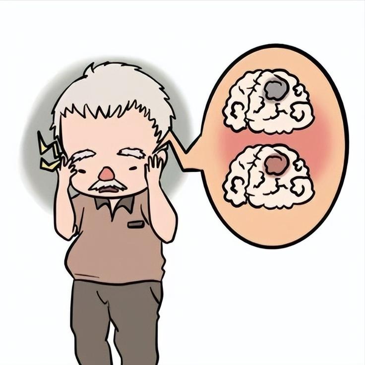 脑梗朋友请收好这篇文章！关键时刻能救你一命前兆先看“5多2晕”：如果最近突