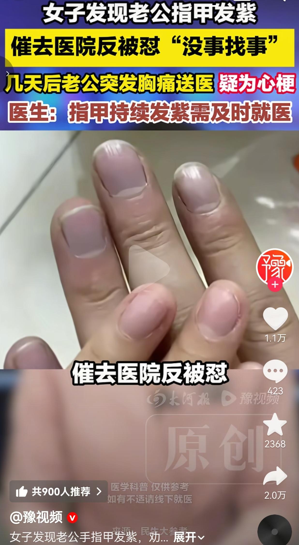 这哪是没事找事，这是拿命在赌啊！老婆一眼发现老公指甲发紫，催着去医院检查，结果被