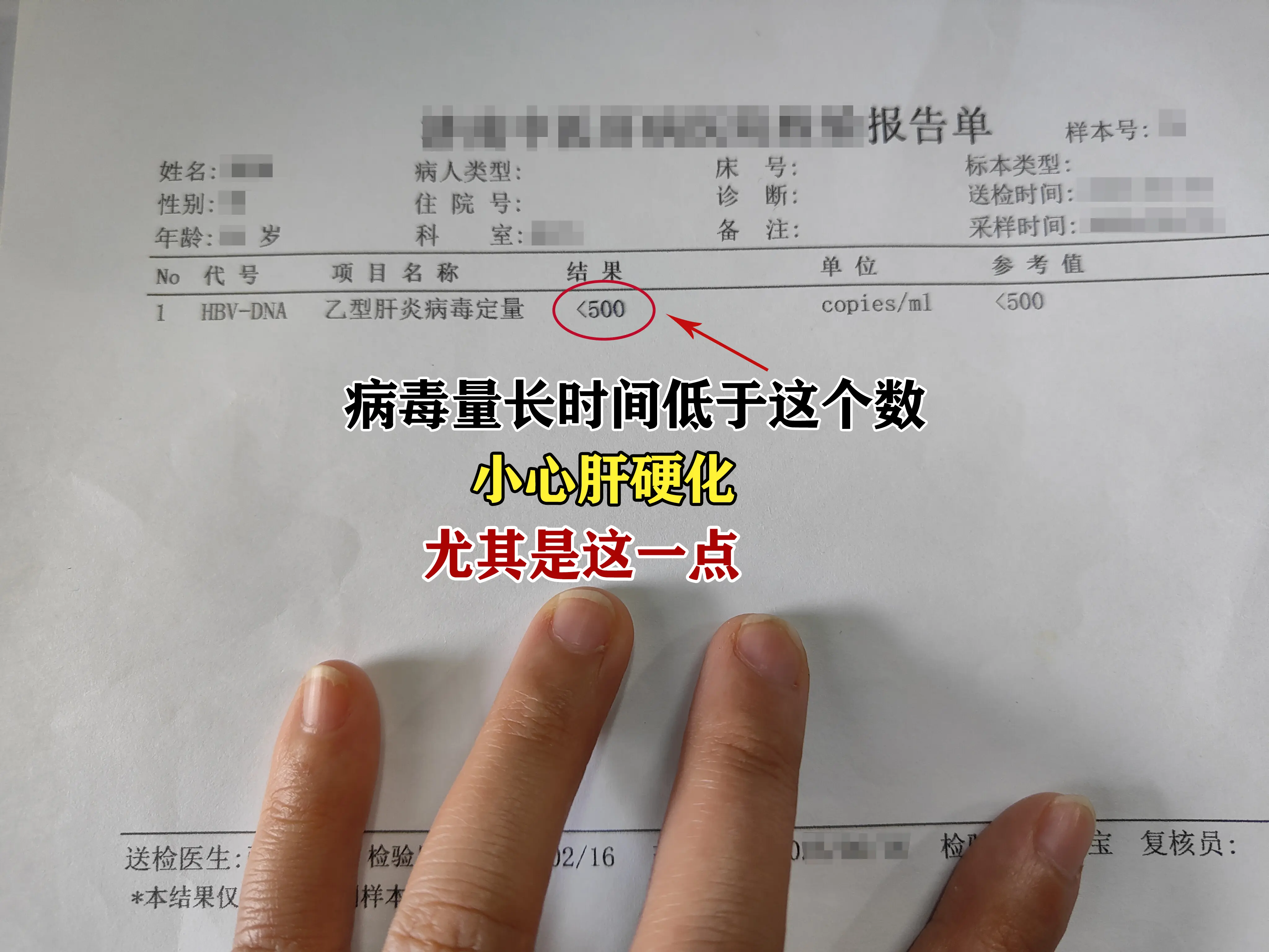 上周末有位来复查的患者，病毒量一直在500以下，却查出了肝硬化，患者很...