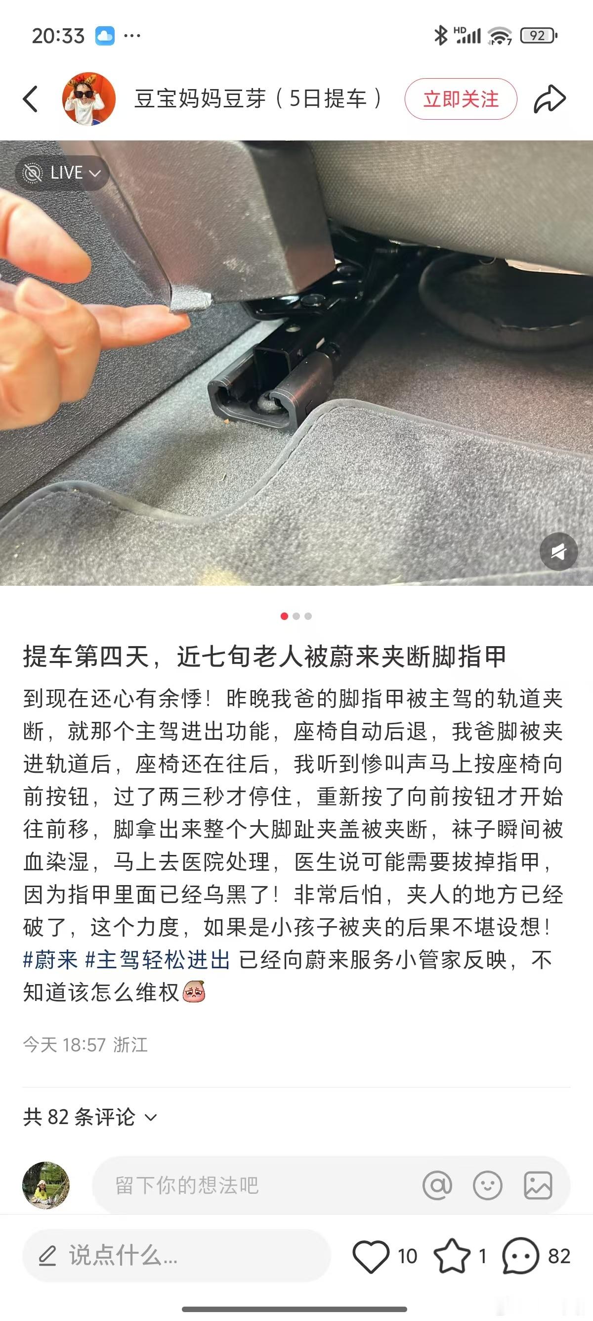 之前那次小鹏二排悬空娱乐屏夹手就说过，如果所有能够电气化移动的部件都设置防夹，那
