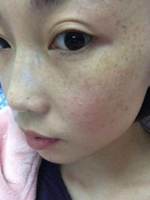 厨房几毛钱的“它”加蜂蜜, 每天早上擦脸, 一个月后再无斑点皱纹