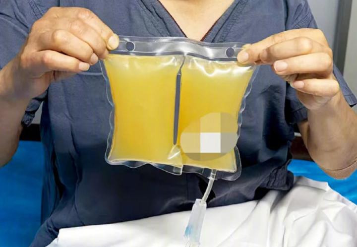 “有钱难买健康”，6月11日，上海，一位42岁的大姐花了不菲的价钱，亲身