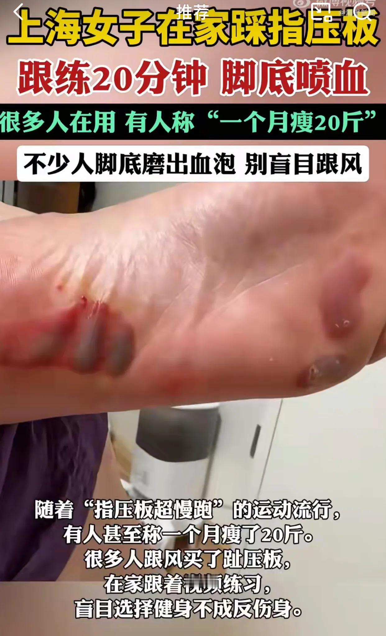 为了减肥，这也太夸张了吧！从去年开始我们办公室的女同事都在聊这个神器，这个风有
