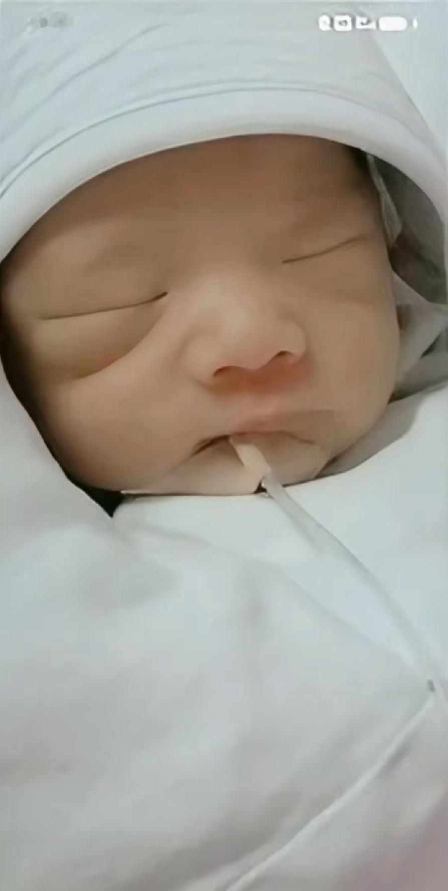 家里人一开始真没当回事。说是累着了，就一直睡觉，喂奶也不太吃。带到社区医院一查血