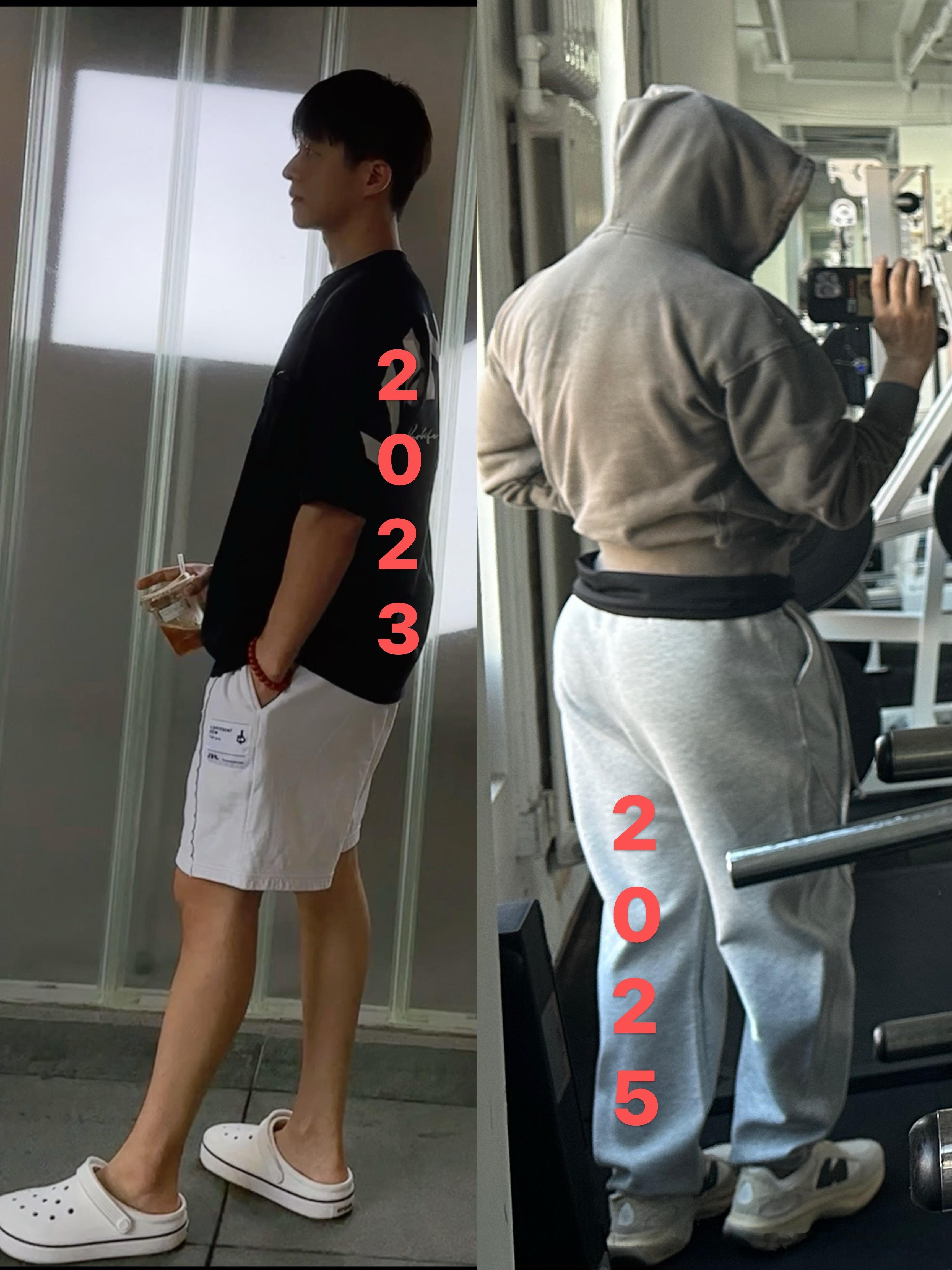 健身张宏涛2019开始接触健身20231月颈椎压迫神经肌肉无力逐渐萎缩