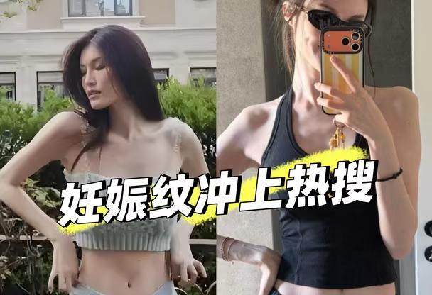 超模何穗也有妊娠纹！这就是孩子到来的痕迹明星生活的另一面明星不止AB面明星