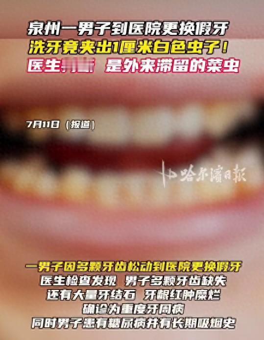 “头皮发麻！”7月9日报道，福建泉州，一男子不太注意口腔卫生，他假牙戴着很不舒服