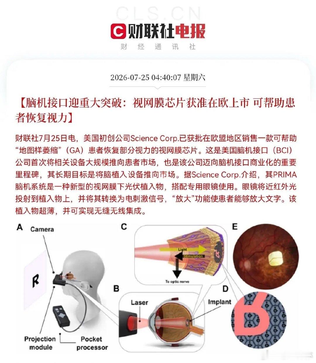 重大消息！重大消息！脑机接口迎来利好消息了，这下好了，满仓脑机接口的要乐开花了，
