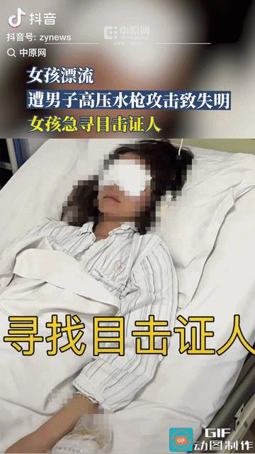 太惨了，旅个游一只眼睛失明！山东一名女孩在玩漂流的时候，被一群男子恶意用高压水枪