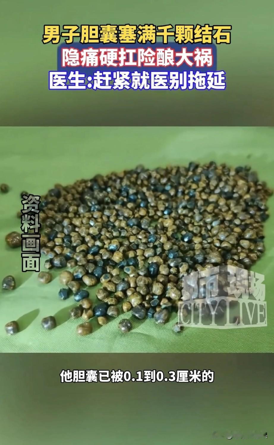 刷到武汉汪先生的新闻时，我第一反应不是“太可怕了”，而是“这不就是我们身边的大多