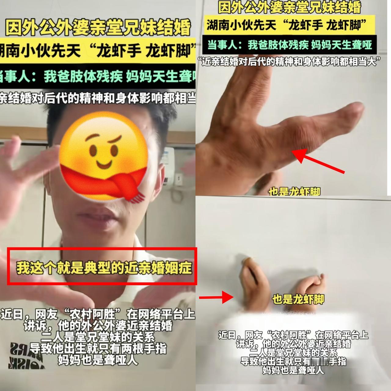 刷到这事真不敢信，这就近亲结婚的代价!湖南一90后小伙的遭遇，看完心里堵得慌