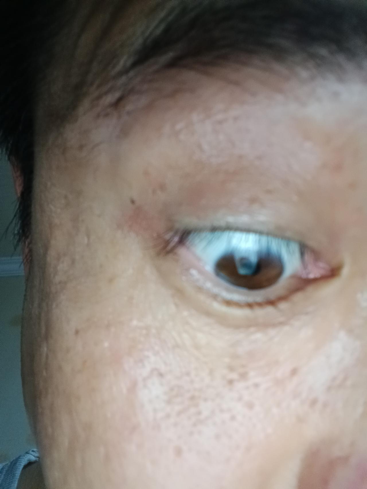 脾虚的人，眼睛永远消不掉红血丝，根源不在熬夜人到中年才慢慢明白。常年眼睛