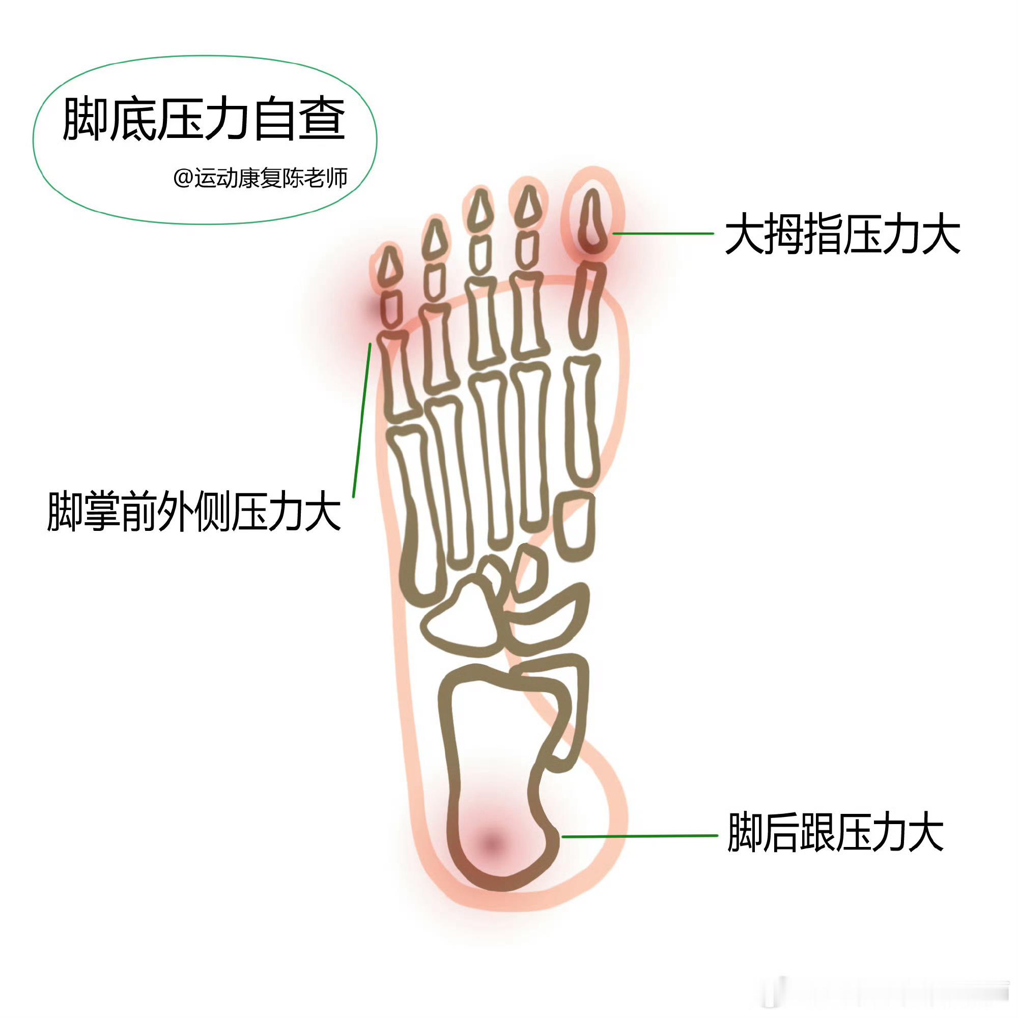 膝盖疼痛没站一会就会觉得腰疼，膝盖疼或者脚底疼，这种情况，很可能是站姿出现了问