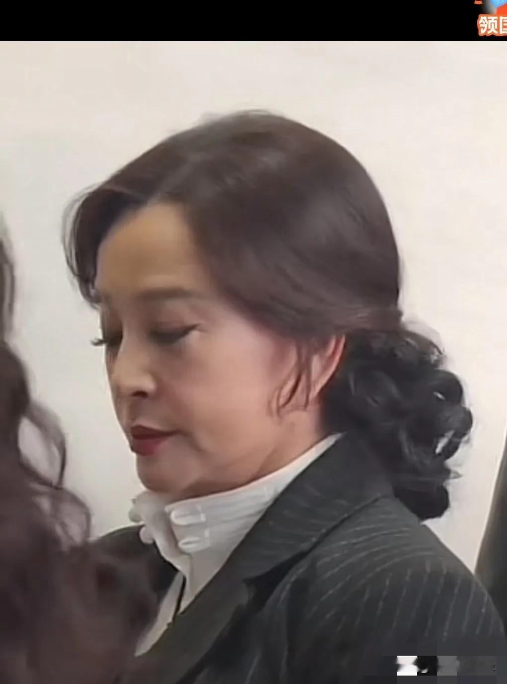 离开美颜滤镜，这才是刘晓庆真实的皮肤状态，各种衰老的皱纹垮脸，医美痕迹明显等问