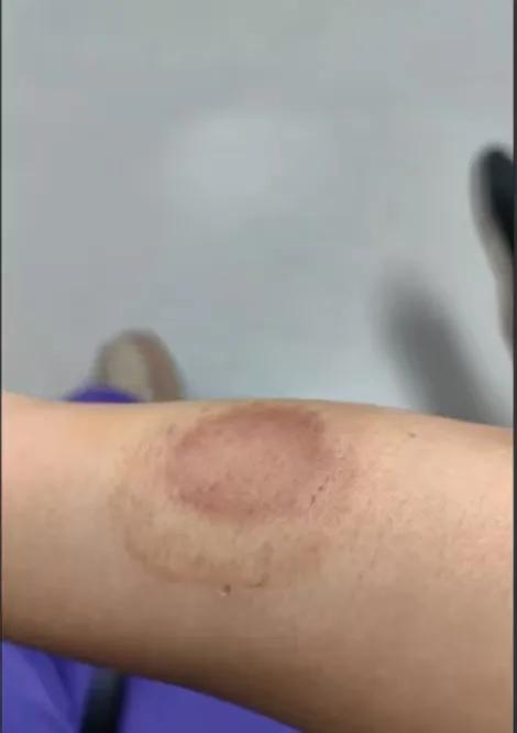 邻里相处讲究和气包容，可深圳这起邻里纠纷，属实让人看得心惊。就因为邻居长期
