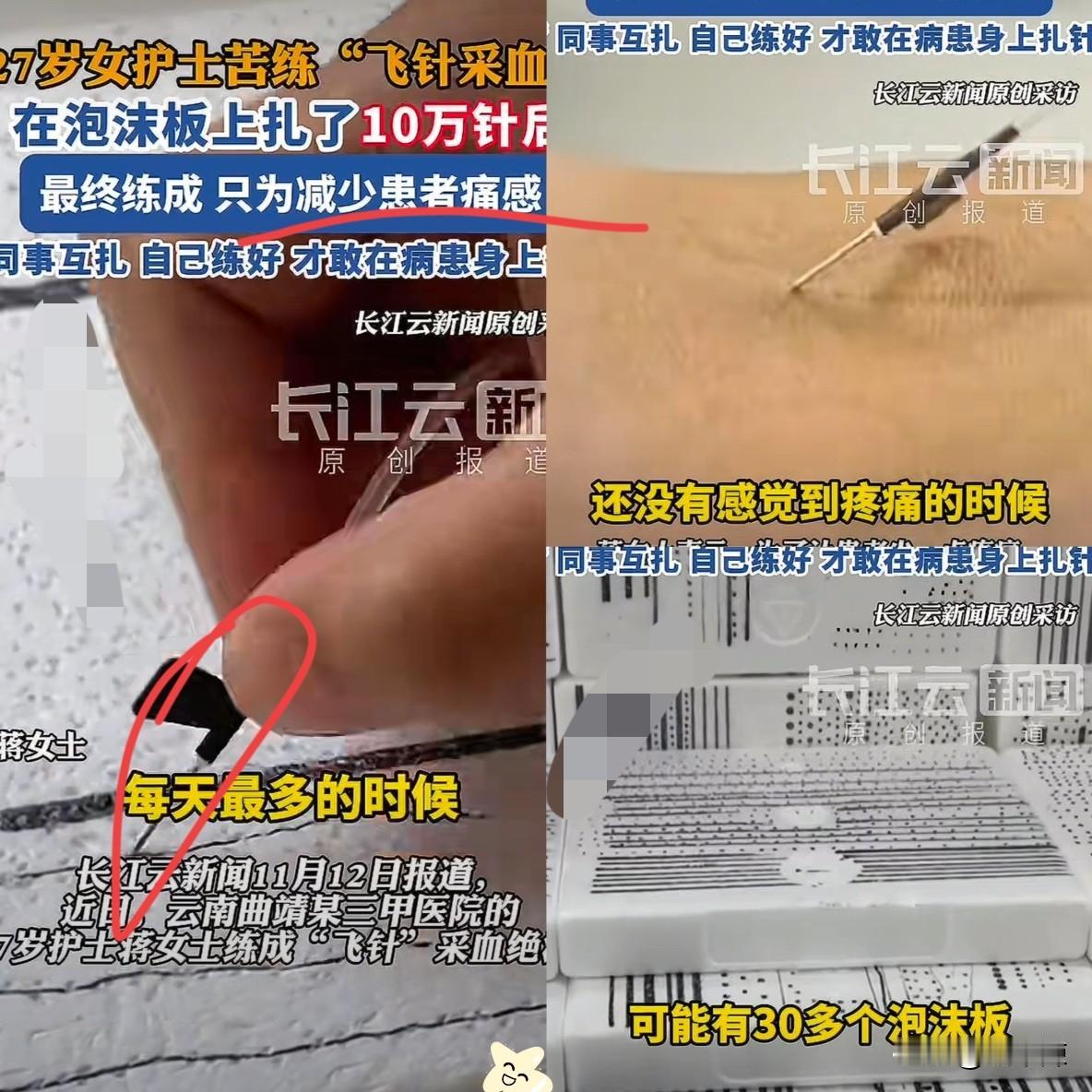 太有毅力了！云南一27岁女护士，为了让患者少一点疼痛，竟然花一个多月时间，苦练“