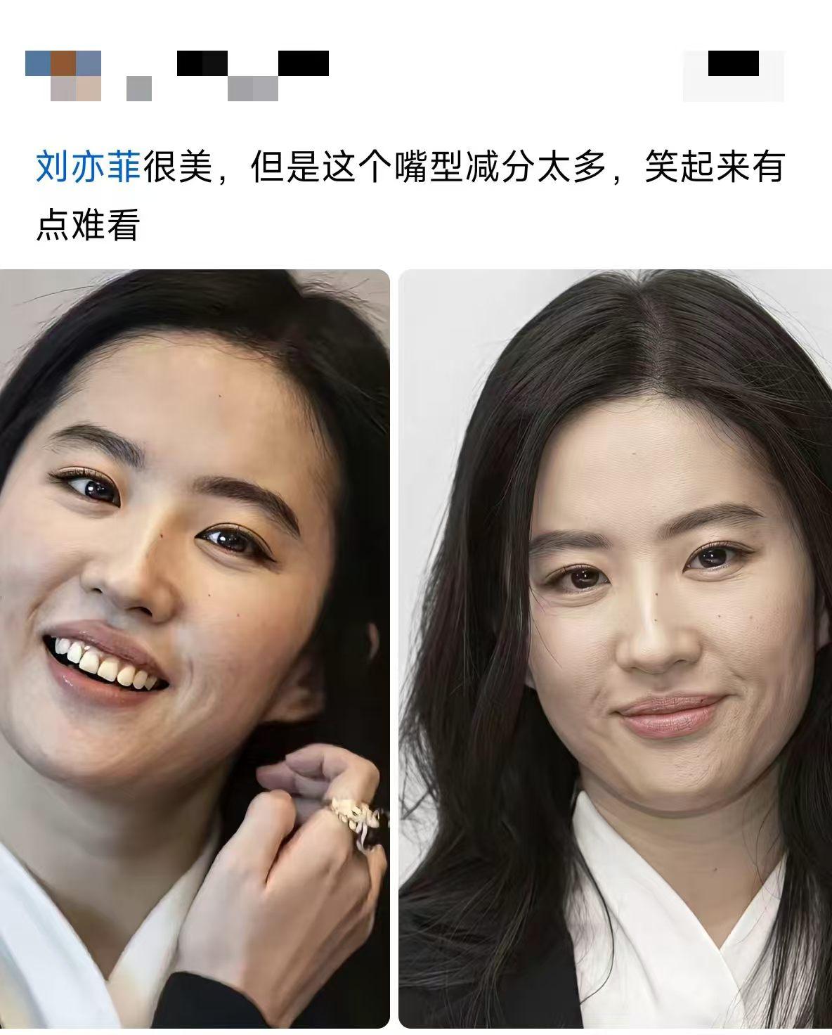 刘亦菲怎么不弄烤瓷牙呢？