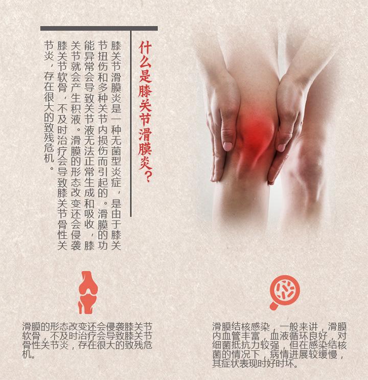临床上几种滑膜炎、膝关节疼痛的最佳治疗方法