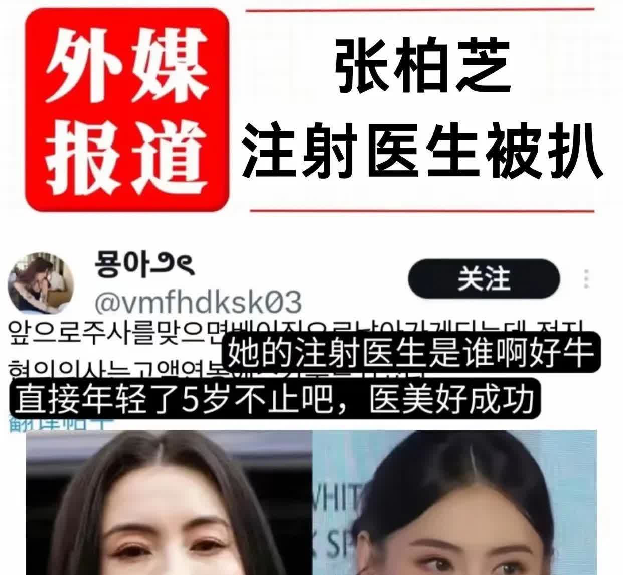 酸了，张柏芝重返青春！有钱真好，有钱就可以青春不老，没钱只能自然老去