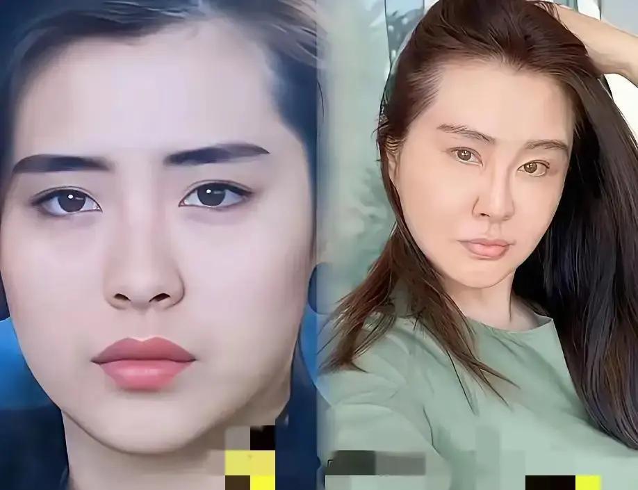 57岁王祖贤脸僵成蜡像，真相竟不是医美她6月出现在温哥华中医展，教老外艾灸