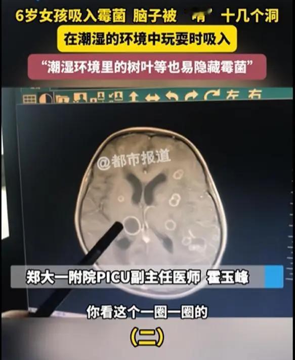 太可怕了！河南一个才6岁的小女孩，连续发烧17天，后来连意识都不清了，赶紧转到