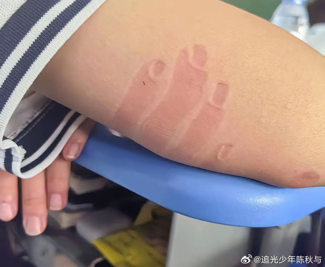 这才是真正的人体皮肤拓印第一次见这么骨节分明的手人怎么能睡成这样[大笑]校园热梗