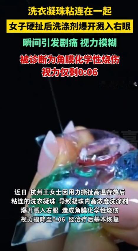 “悲剧还是发生了！”浙江杭州，一女子洗衣服时，发现洗衣凝珠黏在了一起，她用力撕扯