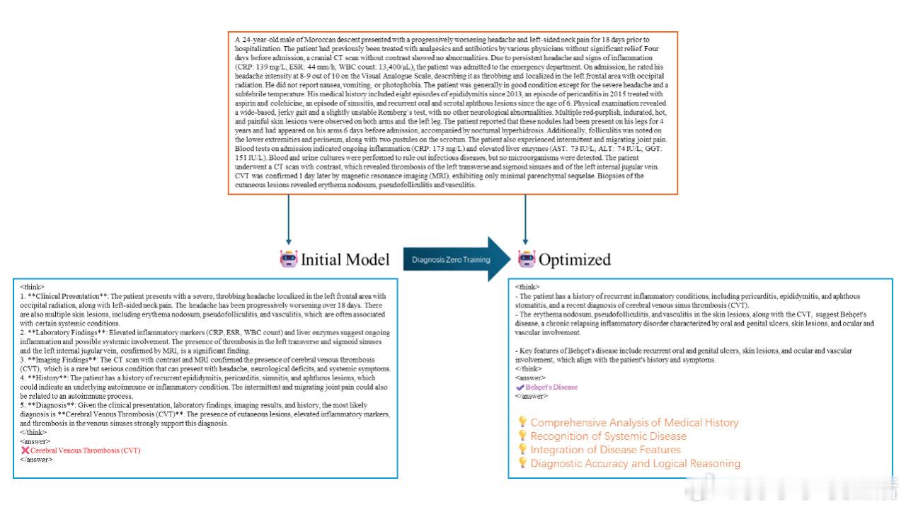 【[11星]DiagnosisZero：基于DeepSeekR1Zero的罕