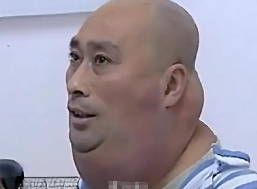 2013年，一名东北男子脖子肿得像游泳圈一样，跑去医院，医生看完连连摇头，说没法