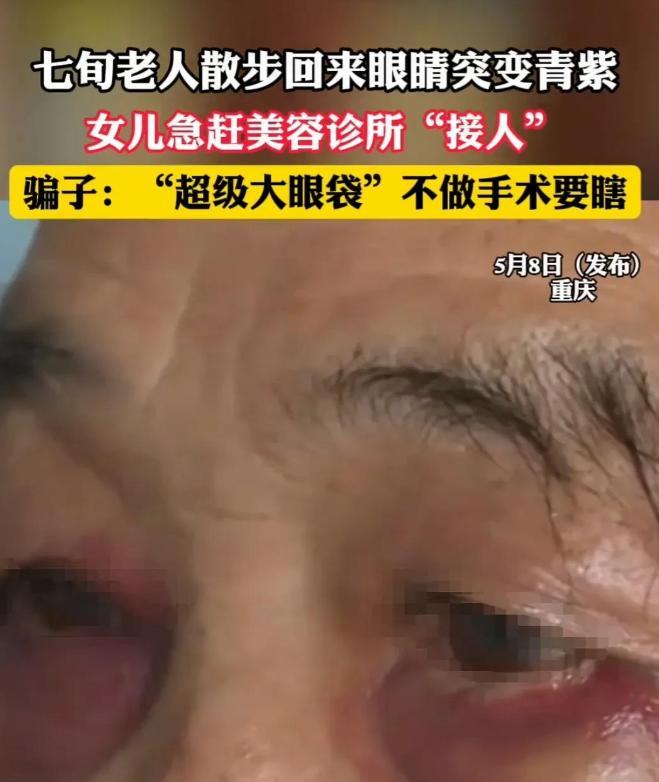 70多岁老人出个门眼袋被割了！虽然说爱美之心人皆有之，但这种事我也是第一次听说。