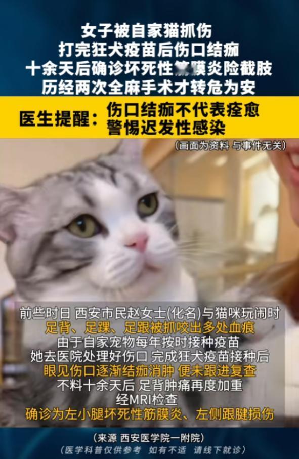 悲剧还是发生了！8月12日报道，陕西西安，一女子被自家猫抓伤，她打完狂犬疫