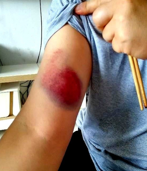 我老公第一次为了婆婆打我了，后来我给娘家弟弟打电话，弟弟把我表哥、表弟、堂哥、堂