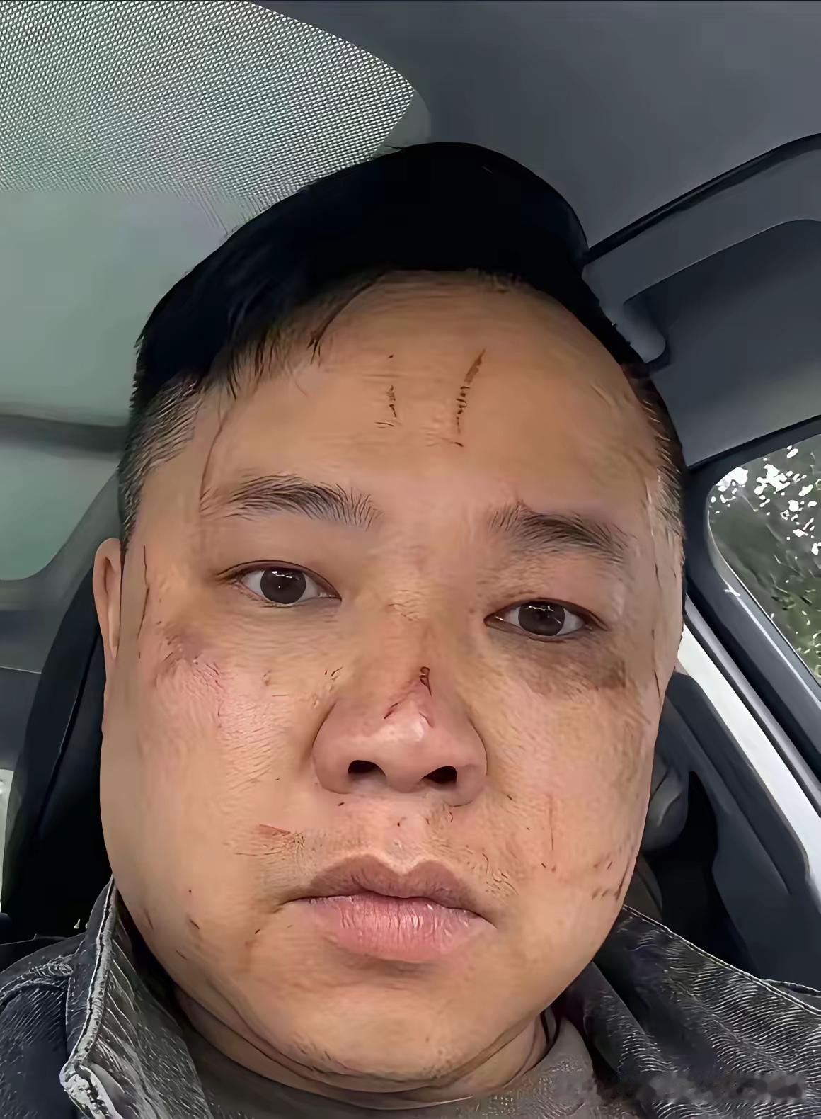 听妈妈的话离了婚，如今直接变成大型社死尴尬现场！男子当初完全听母亲安排，执