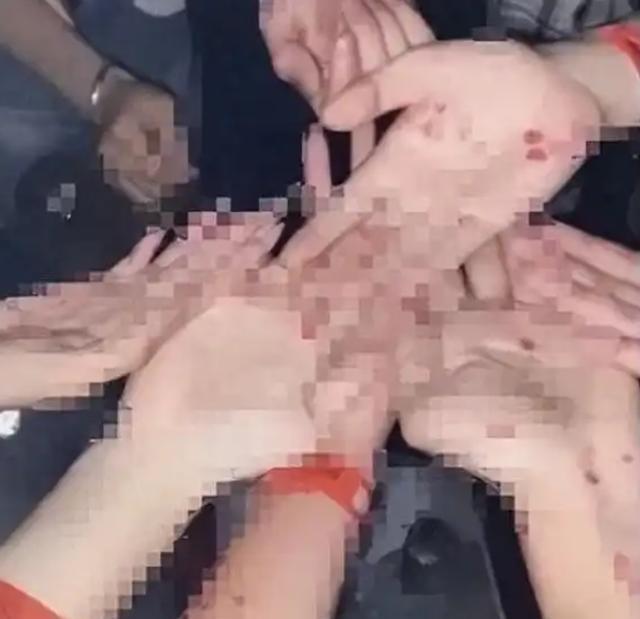 日本梅毒大爆发，确诊病例高达13000例。更要命的是，这些感染者，不以为耻，反以