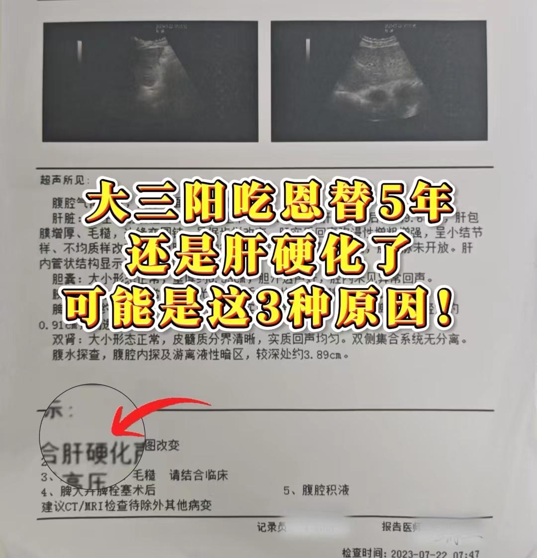 在临床上经常遇到刚刚确诊肝硬化的患者问我：教授，为什么之前一直坚持吃抗...
