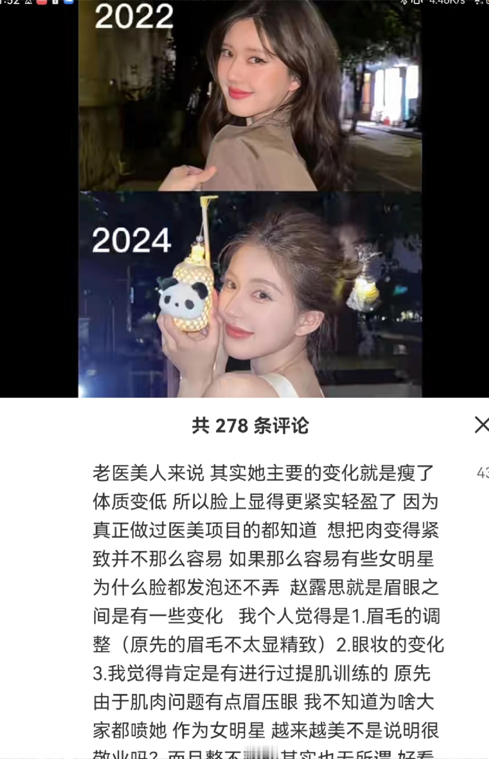 很多做过医美的人都说赵露思没有整容但是大家都不信​​​