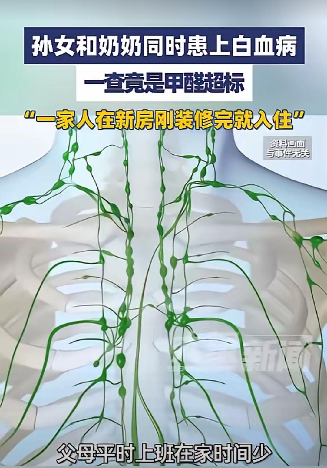 新房装修完别盲目入住！河南南阳一家的悲剧敲响警钟，老人孩子接连得白血病，罪魁祸首