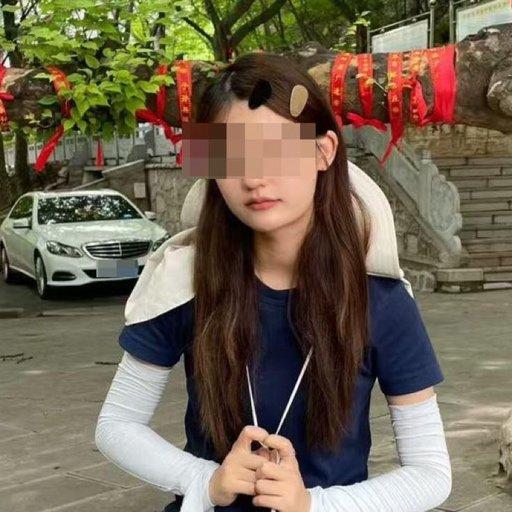 19岁大学生熬夜直播突发脑出血致瘫事件山东有个19岁的女大学生叫王蕊，原本