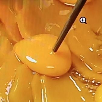 家人们，我发现了一款新奇又简单的懒人早餐做法——南瓜打入四个鸡蛋！先把南瓜去皮