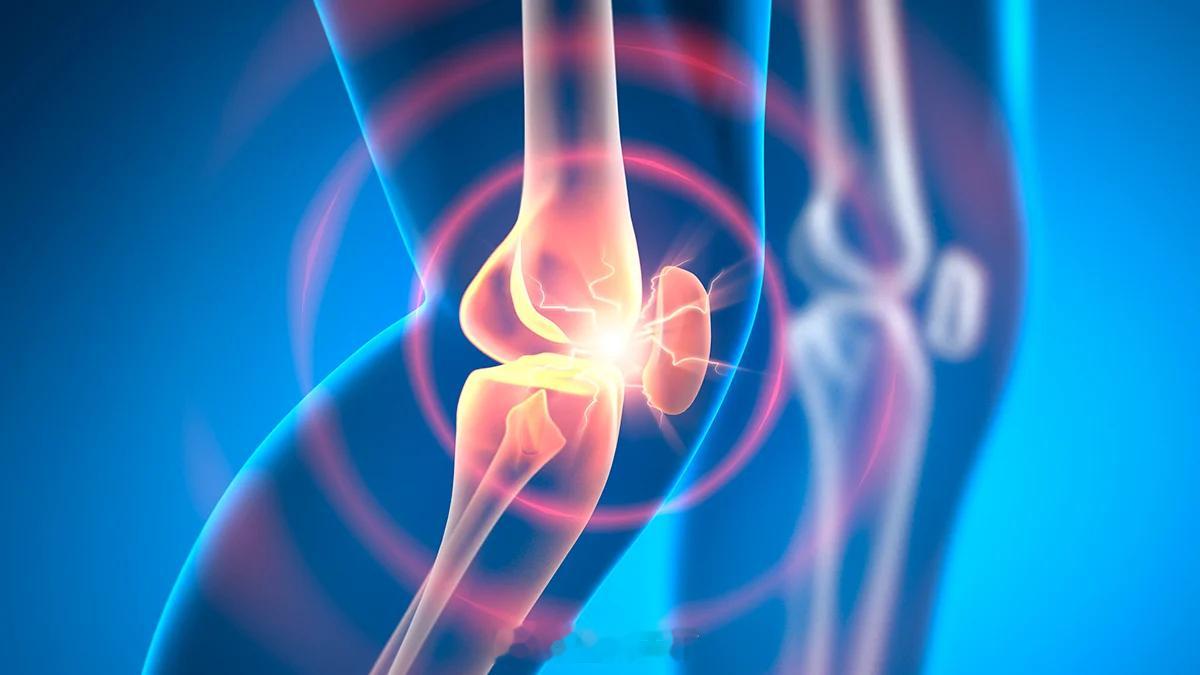 实验性药物在动物模型中数周内逆转骨关节炎ScienceAlert报道总结科罗