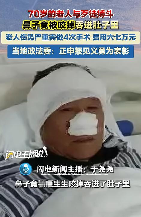 恶徒残暴行径天理难容！湖南郴州70岁老党员曾凡林勇斗失控歹徒，救人时鼻子