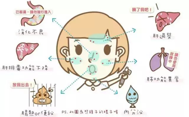 “战痘”的青春, 中医和西医分别是怎么治疗痘痘的?