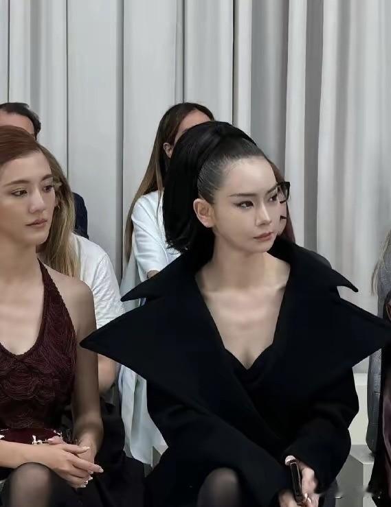 吴千语的贴头皮还算正常，戚薇的贴头皮简直是在拉皮啊，看着就脸疼头疼。