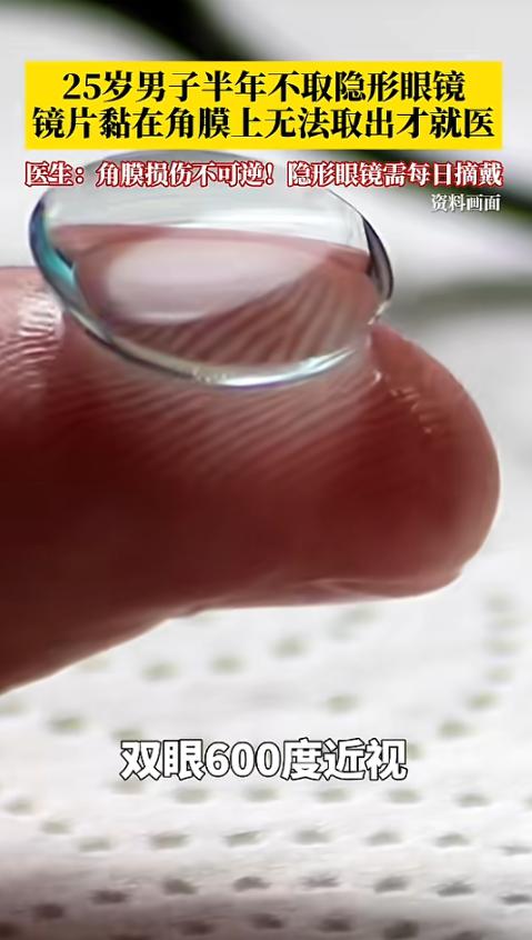 “悲剧还是发生了！”湖北，一男子双眼高度近视，戴了7年的隐形眼镜，最近半年，因为