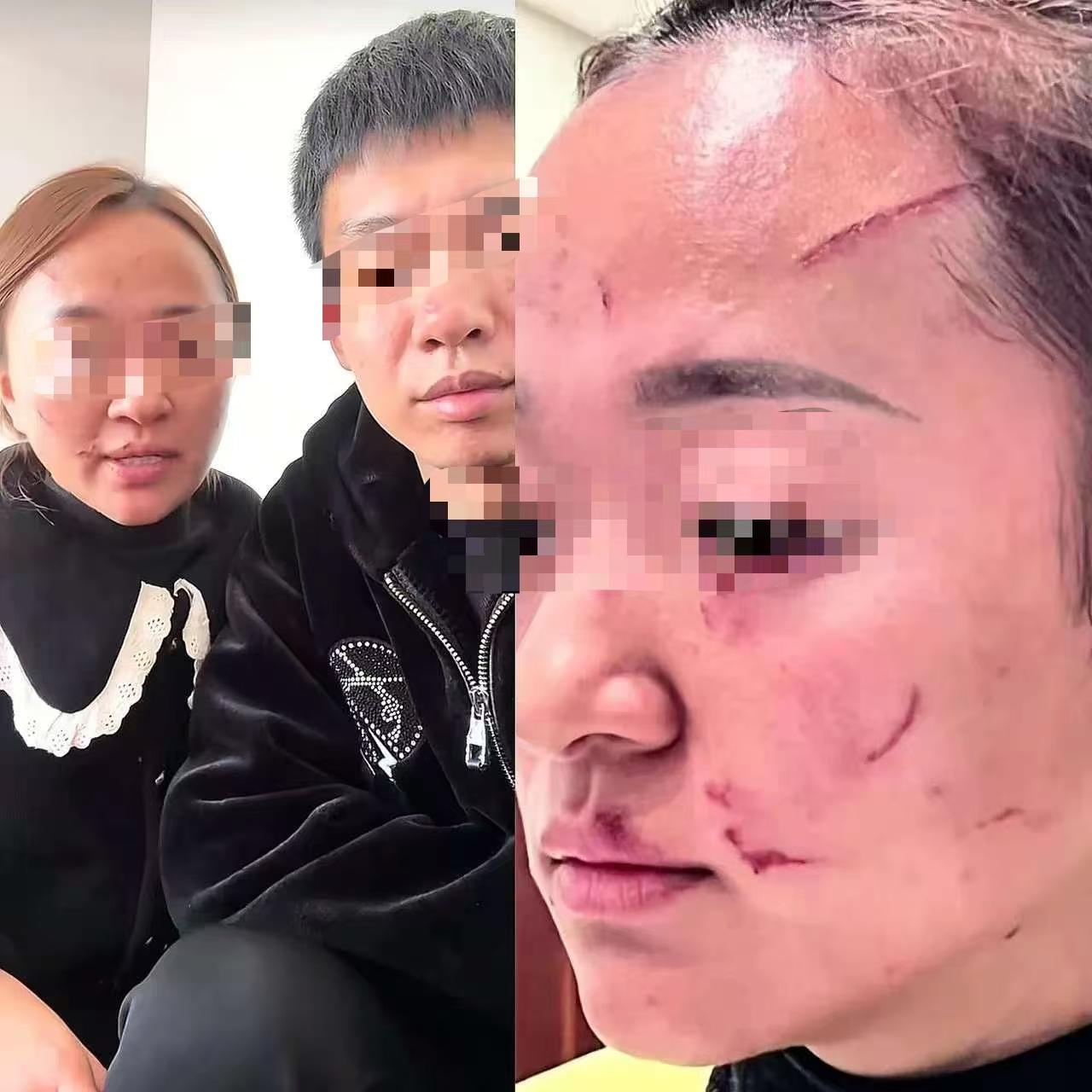 又一起婆媳冲突冲上热搜，这次动手地点在河南洛阳的某小区，视频里婆婆和儿媳扭打成一