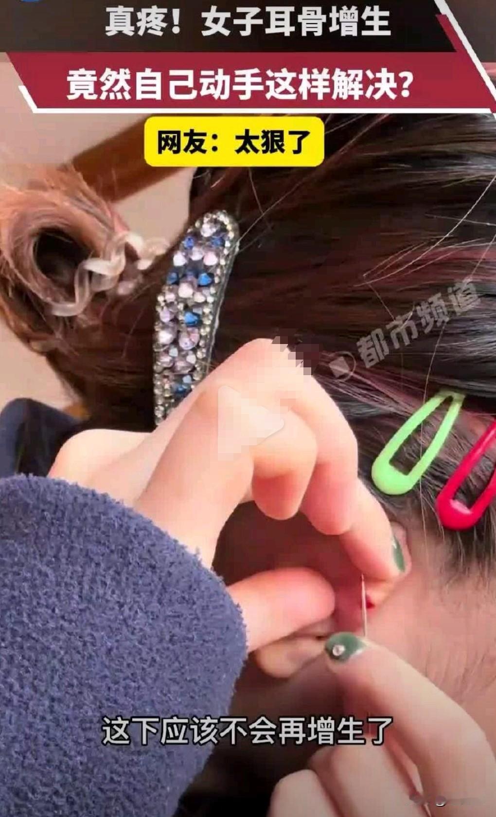 这种人真的是太狠了吧。为什么不去医院解决呢?竟然自行解决,这真的是不知说什么好