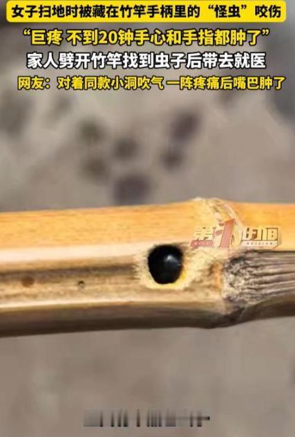 万万没想到！四川雅安，一位女子在家里扫地时，竟被扫把柄里窜出的一只“怪虫”狠狠咬
