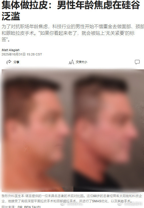 【中年男人的回春三件套：减肥针、医美、Hyrox】打减肥针做医美参加Hyrox的