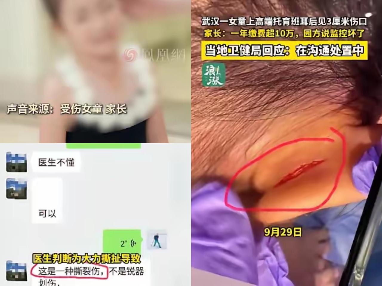 必须严惩！湖北武汉，一女子把孙女送进一家高端托儿所，每年费用10万多，结果9月1