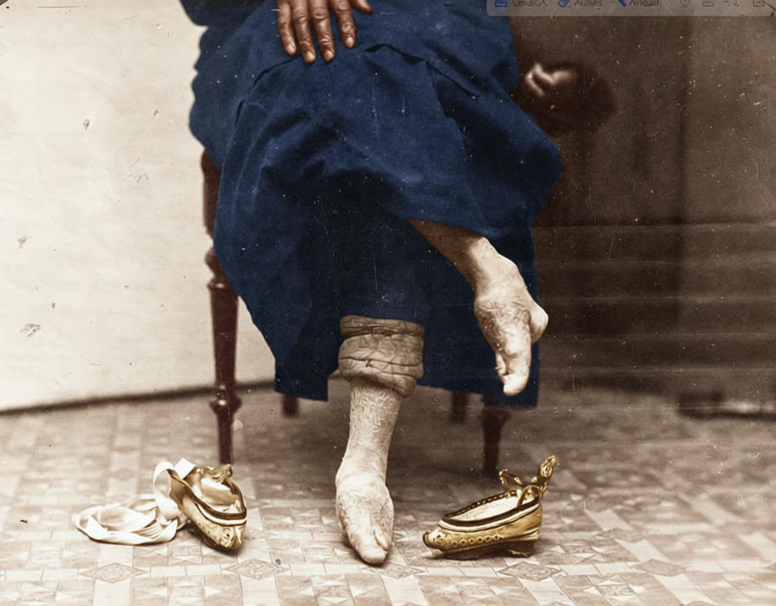 这张照片里的画面满是封建审美对女性的残酷压迫，女子裤脚挽起，露出的“三寸金莲”脚
